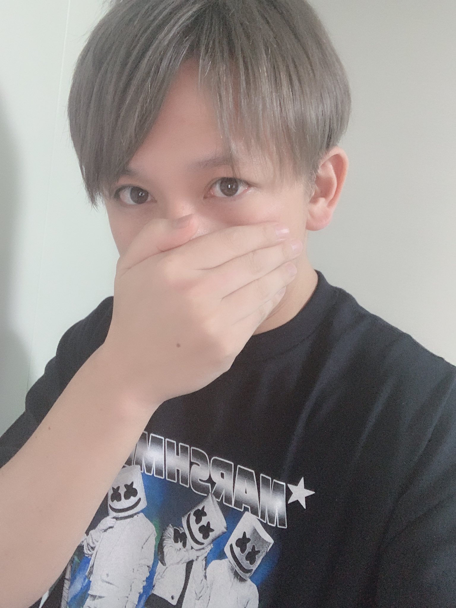 玉澤　ゴリラクリニックヤウチモデル　左投げ LOUIS CLINIC 二子玉川 | 元々のやわらかい印象がさらにマシマシ