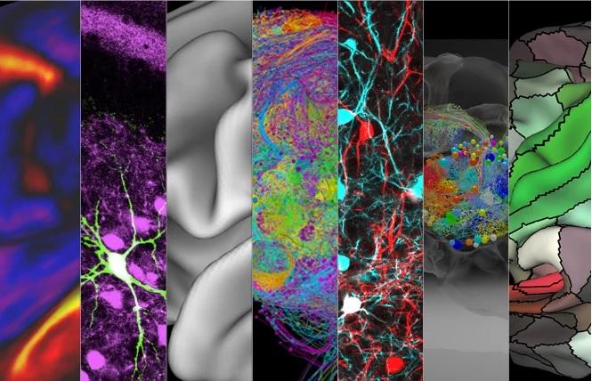 CellPressNews's tweet photo. A new generation of #neuroscientists are using data and imaging processes to give an unprecedented look at the #brain on multiple levels. #CellPictureShow #NeuralMapping https://t.co/X9Ri2C6A0z https://t.co/bnGCH9vTm2