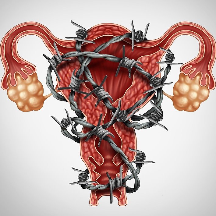 #Periods do not have to be painful &amp; tiring!

3 tips to keep you on track:

1. Stay hydrated with water or herbal teas (noo, fizzy drinks don't count 😊)

2. Cut back on sugar at least 7 days before.

3. Get moving - movement ups your endorphins which overrides feeling of pain!