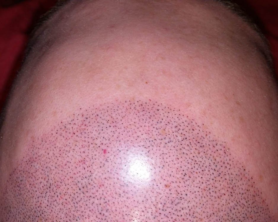 HEADLINERink's tweet photo. We are #dedicated to making sure our #customers are #happy with our #services. What has been your #favoriteexperience with #Headliner.Ink so far? Give Us A Call at # (714) 800-9002 today! #HairTattoo #HeadTattoo #ScalpTattoo #HuntingtonBeach92648 https://t.co/Wxil8uhx3w https://t.co/HBEx9y2mqt