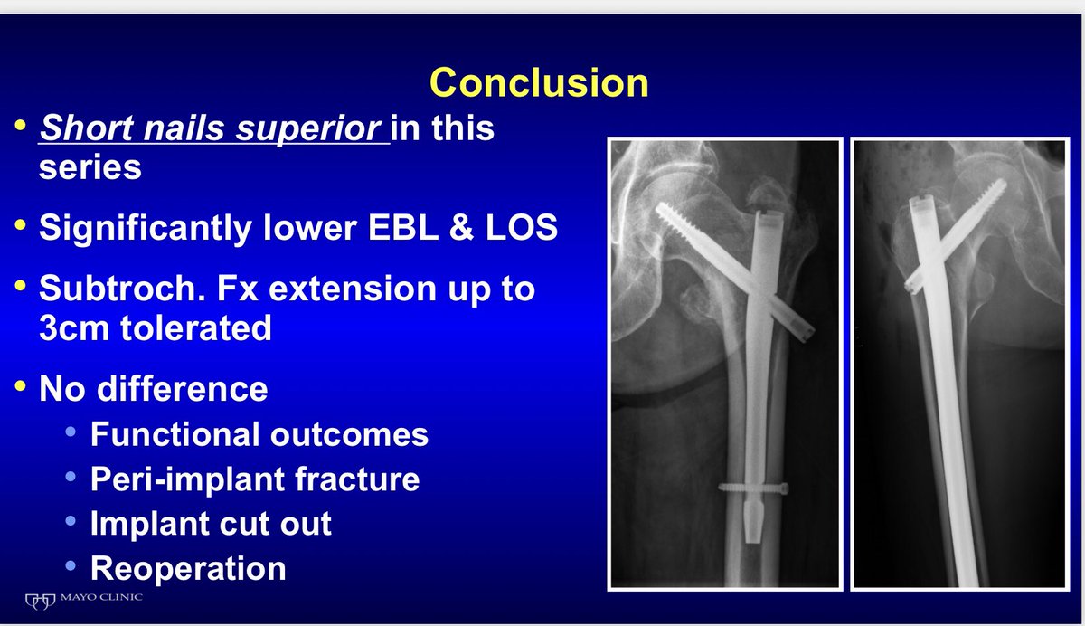 SteveShannonMD's tweet photo. Thanks to @otatrauma &amp; David Teague for presenting us with the Edwin Bovill Award @AAOS1 specialty day for Best Paper of the 2018 OTA Meeting! Myself, @BrandonYuanMD @WilliamCross3MD @JonBarlowMD @MayoOrthoRes @MayoClinic very humbled &amp; honored. #MedEd #fracture #orthotwitter https://t.co/3VZRSniVO8