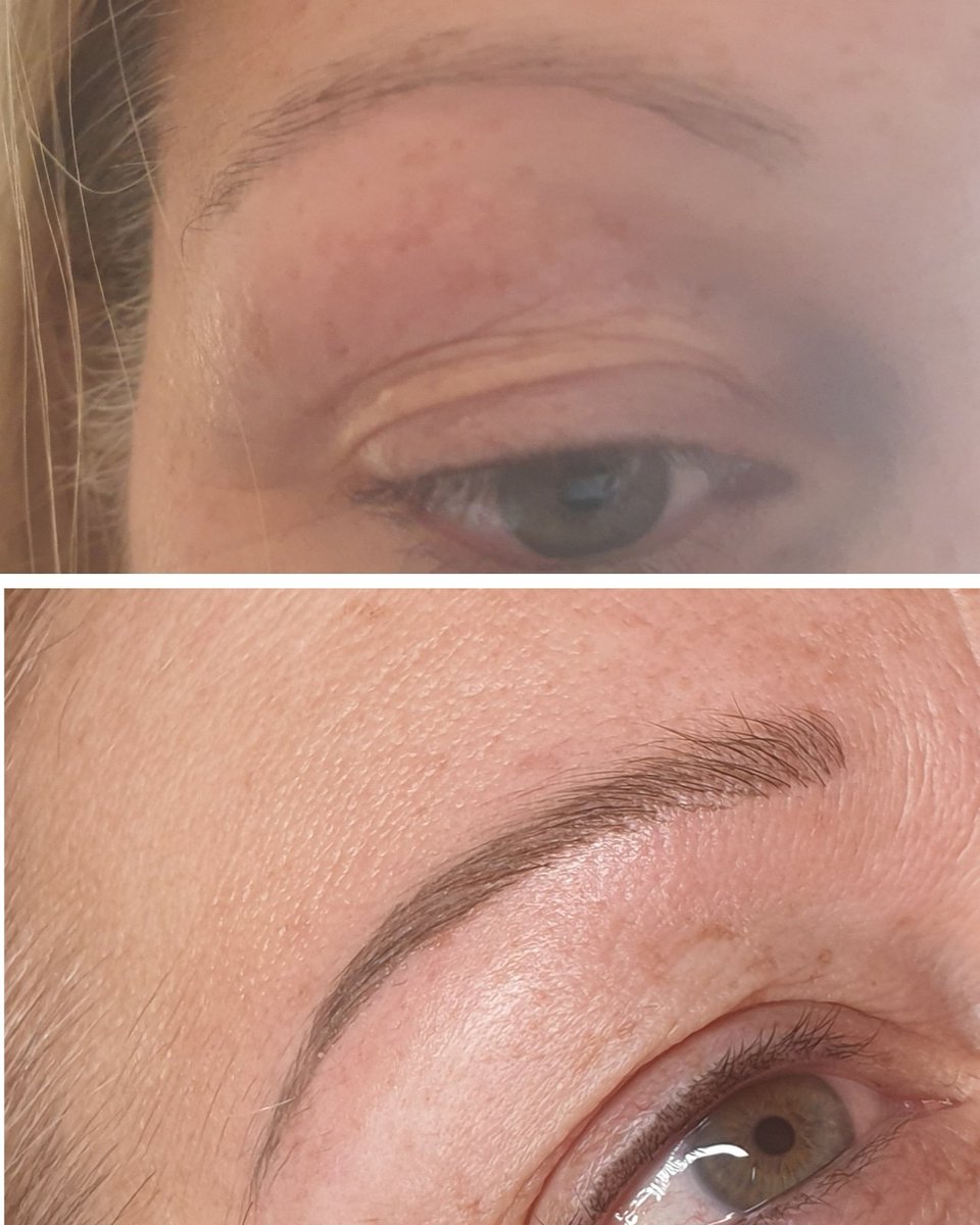 What a transformation! Natural dainty brows for this lovely lady! #semipermanent  #makeup #cosmetic #tattoo #permanentmakeup #pmu #spmu #pmutech #micropigmentation #eyebrows #brows #hairstrokebrows #nottingham #westbridgford #jennystathamaesthetics