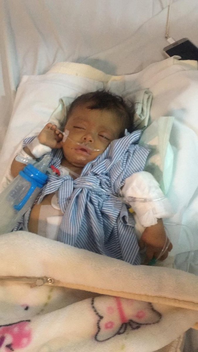 AJELNEWS24's tweet image. ⁧#حالة_انسانية⁩ 🔴
.
.
ذوو الطفلة آلاء عبدالعزيز الوذيناني؛ البالغة من العمر سنة وأربعة أشهر، يُناشدون علاجها في الخارج، حيث إنها تحتاج إلى زراعة كبد، وتعاني انسداداً في أيقونة الكبد، وتعيش بين الحياة والموت.