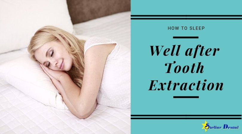 Having a tooth extracted can result in difficulties when trying to sleep. Instead of lying flat, prop your head up with pillows, so it’s slightly above your shoulders. stellardentalllc.com/blog/how-to-sl… #toothextraction