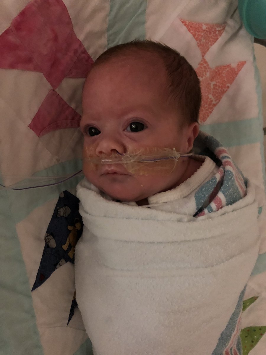 codeofvets's tweet photo. UPDATE BABY MADISON PAIGE: 

5 weeks old
born 28.4 weeks gestation 
Is now 4.11 lbs
feisty
some feeding issues
breathing on her own
heart murmur

Continue praying for Madi! 

Celebrating Life🎉 #ProudGigi https://t.co/JggqAP3RuO