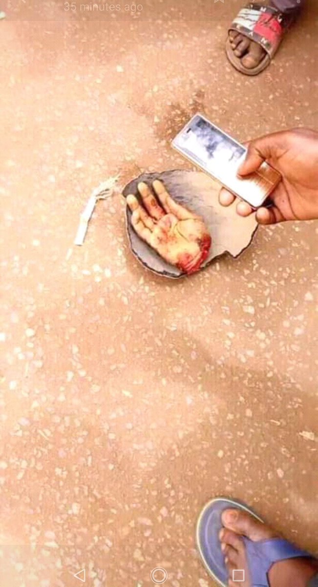 Preposterous!!! Man cuts off his hand that voted for President Buhari because he believes he is complicit in INEC's declearation of Gov. Ganduje as winner of #KanoRerun #NigeriaDecides2019 #Nigeria