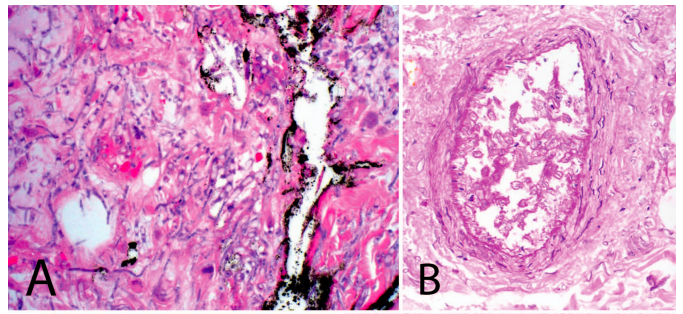 Arch Pathol Lab Med tweet media