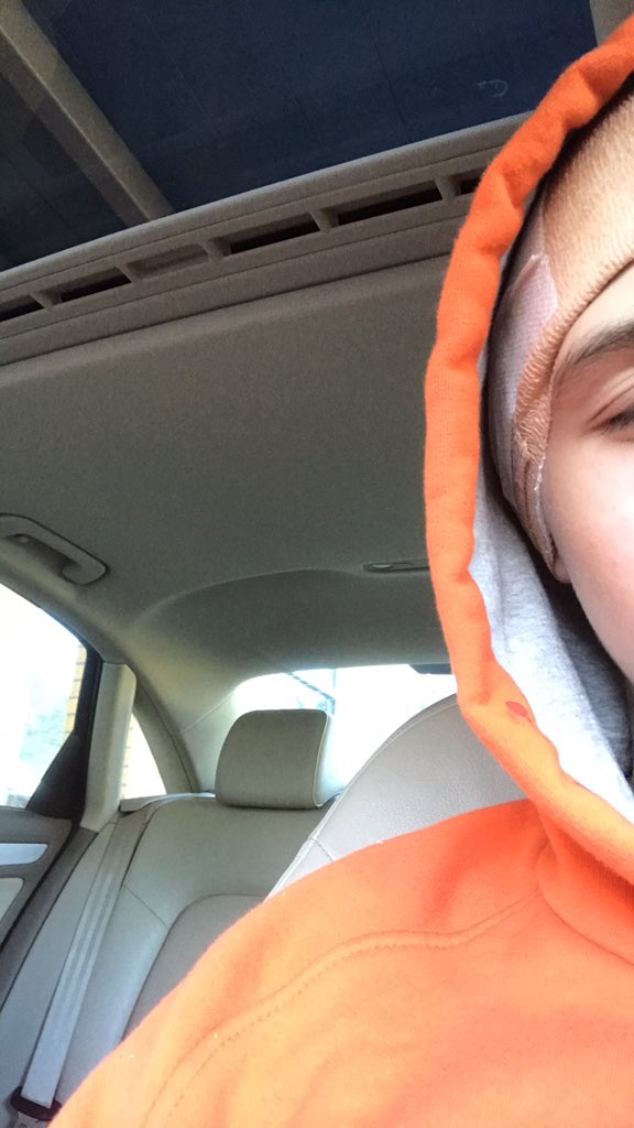 FEELZBADTTV's tweet photo. Just got needles put in my head for about 2 hours guess that’s what I get for tripping up, prey for me🤕 https://t.co/Glwtes3bwN