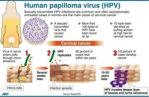 wef's tweet photo. 4 steps towards wiping out cervical cancer https://t.co/P3UAtIzAXg