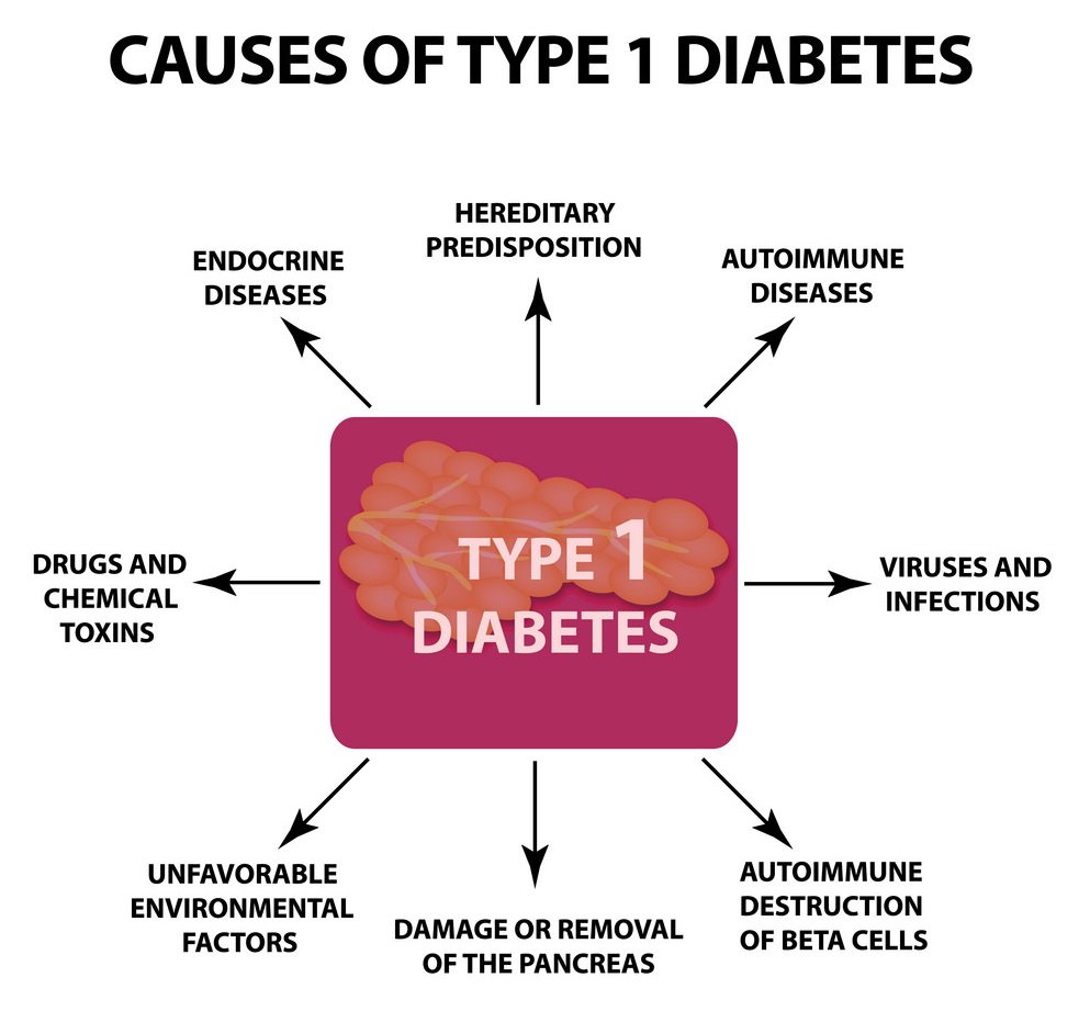 Diabetes Type 1