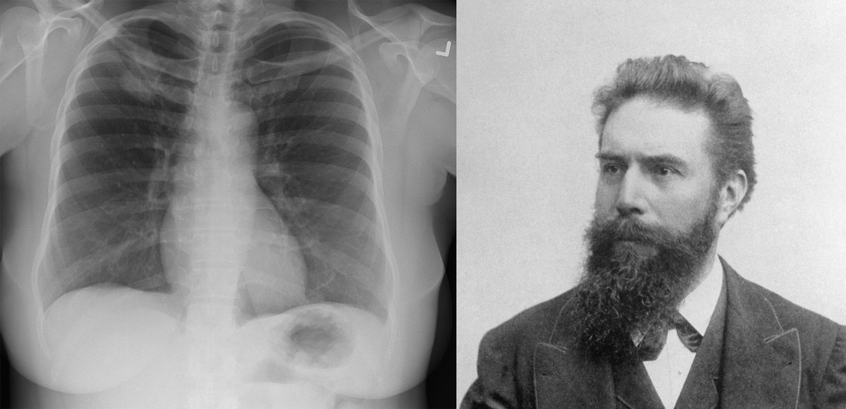 NobelPrize's tweet photo. Today we are celebrating Wilhelm Röntgen, born #OTD, awarded the first #NobelPrize in Physics 1901 for the remarkable rays named after him. Röntgen preferred the term X-rays - from the mathematical designation for something unknown - as no one understood what the rays were. https://t.co/mQfflAxDuX