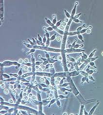EditorJmbt's tweet photo. #Genetic Characterization of Trichoderma spp. Isolated from Different Locations of Menoufia, Egypt and Assessment of their #Antagonistic Ability
https://t.co/BU6oUXygW3 https://t.co/jY1h0rOCCE