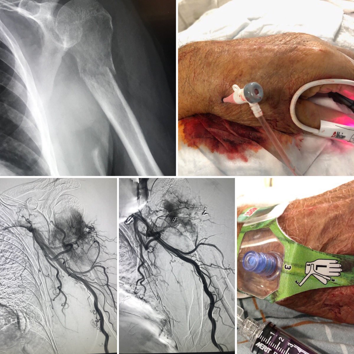 Sumeet Bahl, MD tweet media