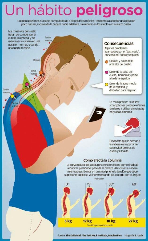 #Infografía ¿Cómo afecta a la columna mirar tanto el móvil?  vía <a href="/EquipodelaTorre/">Equipo De la Torre</a>