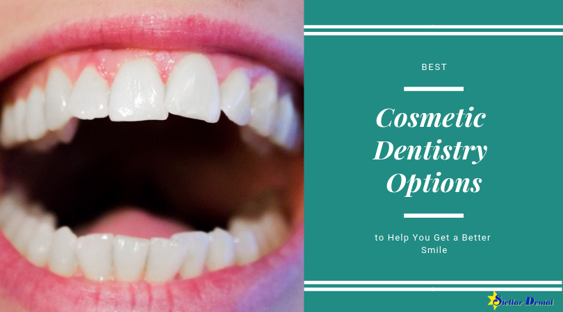 Cosmetic dentistry is trending nowadays because of its increasing popularity as a good option to improve the beauty of your smile. Read more. stellardentalllc.com/blog/best-cosm… #cosmeticdentistry #smile