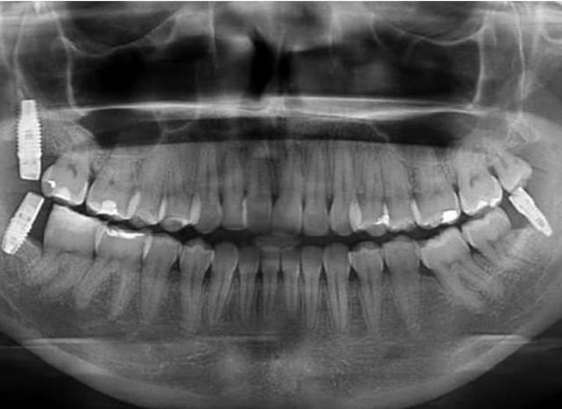 تعليقكم! 😱😱😱

شكل الدكتور عليه ديون
<a href="/alhadab/">فيصل الحدب</a> <a href="/aboutDent/">عن طب الأسنان | AboutDent</a>
