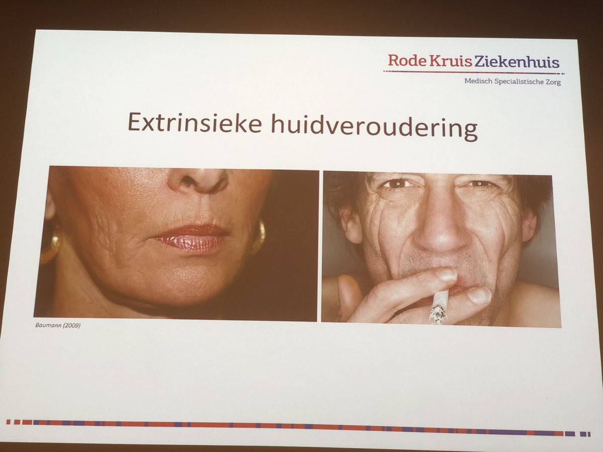 20.  De dermatoloog en roken 
#doktersuitdespreekkamer <a href="/VvAA/">VvAA</a> 

Kaal 
Geel 
Rimpels 
Hijs rimpels rond de mond

drleenarts.com