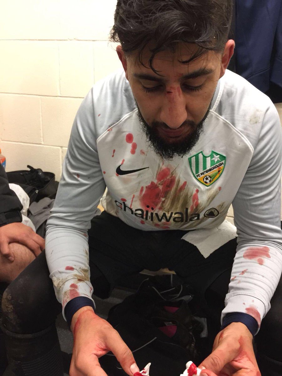 RebeccaTVnews's tweet photo. Read Zeeshan’s story. He claims he was head butted during a game and racially abused after it. My report: https://t.co/PYE5r0FIiE https://t.co/ioxufbXKtj
