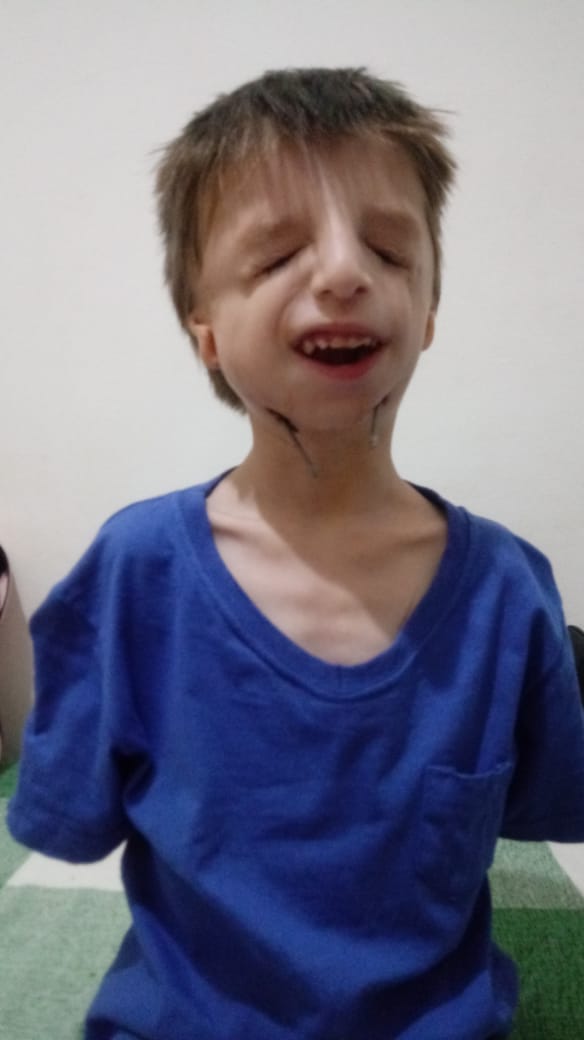 andysoeth_'s tweet photo. Queria a atenção de vocês pra esta causa, esse é o João, ele tem 4 anos e é portador da síndrome Treacher Collins. No momento ele está em São Paulo fazendo o tratamento e ficará lá por mais ou menos 20 dias, porém os gastos são MUITOS ++ https://t.co/yoFrGyqLoy