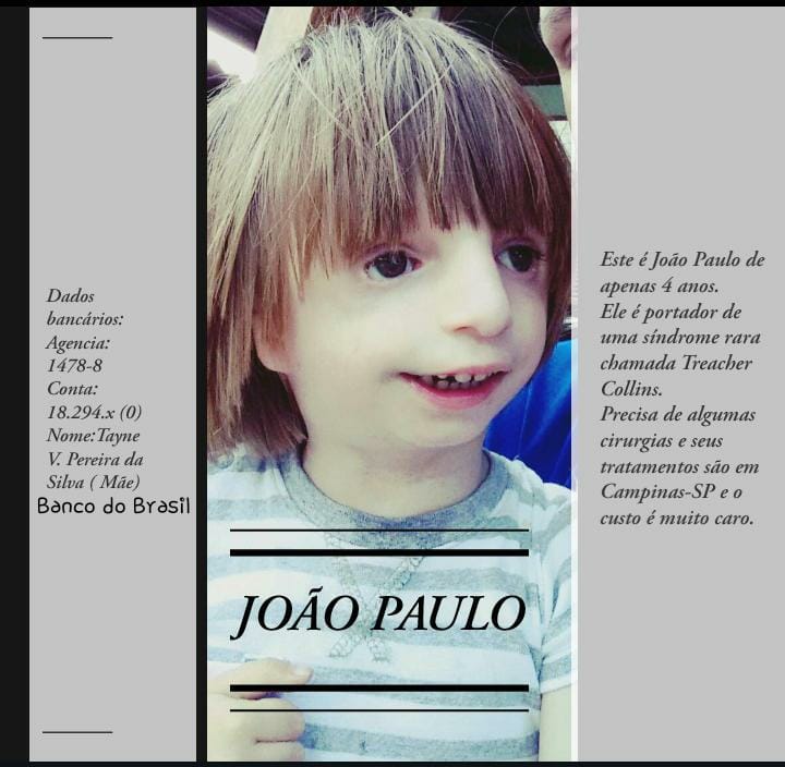 andysoeth_'s tweet photo. Queria a atenção de vocês pra esta causa, esse é o João, ele tem 4 anos e é portador da síndrome Treacher Collins. No momento ele está em São Paulo fazendo o tratamento e ficará lá por mais ou menos 20 dias, porém os gastos são MUITOS ++ https://t.co/yoFrGyqLoy