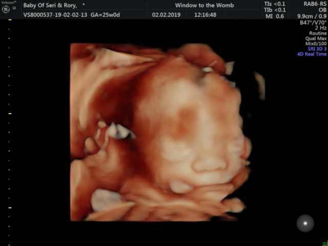 SeriTaylor's tweet photo. 7 weeks to go princess. Mummy and daddy love you so much already 💕 https://t.co/IQWR0fTjEw
