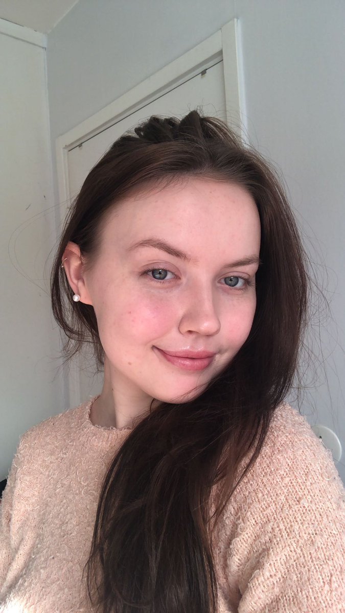 slutjjk's tweet image. this is how my social anxiety started and developed into depression, this made me unable to look people in the eye because i was so disgusted by myself, i still can’t do it but i’m making progress, today i barely get a single pimple thanks to accutane, it truly saved my life.