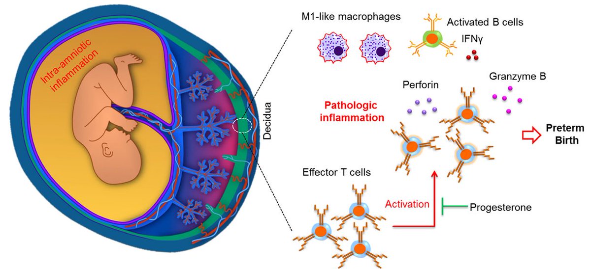 Finally! My PhD first author paper is out! Click here to know how T cells can induce preterm labor and birth: jimmunol.org/content/early/… @nardhygomez @AJOGEd_RR @xyyixu @bogdanP007 @valeriaqbp @derektm9 #NGLlab @J_Immunol