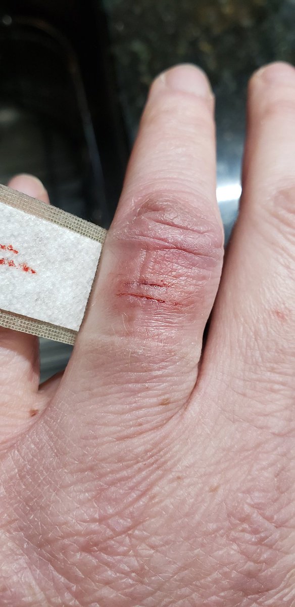 So got a booboo today.  I think it is a sign of the tattoo I should get on the finger when it is healed up. =