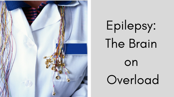 SPMinc's tweet photo. "Nearly 300,000 American children under the age of 14 have epilepsy." https://t.co/wRyBW3LhnM 

Thanks to @amssvs for this month's blog post. https://t.co/GEgzimoAUF
