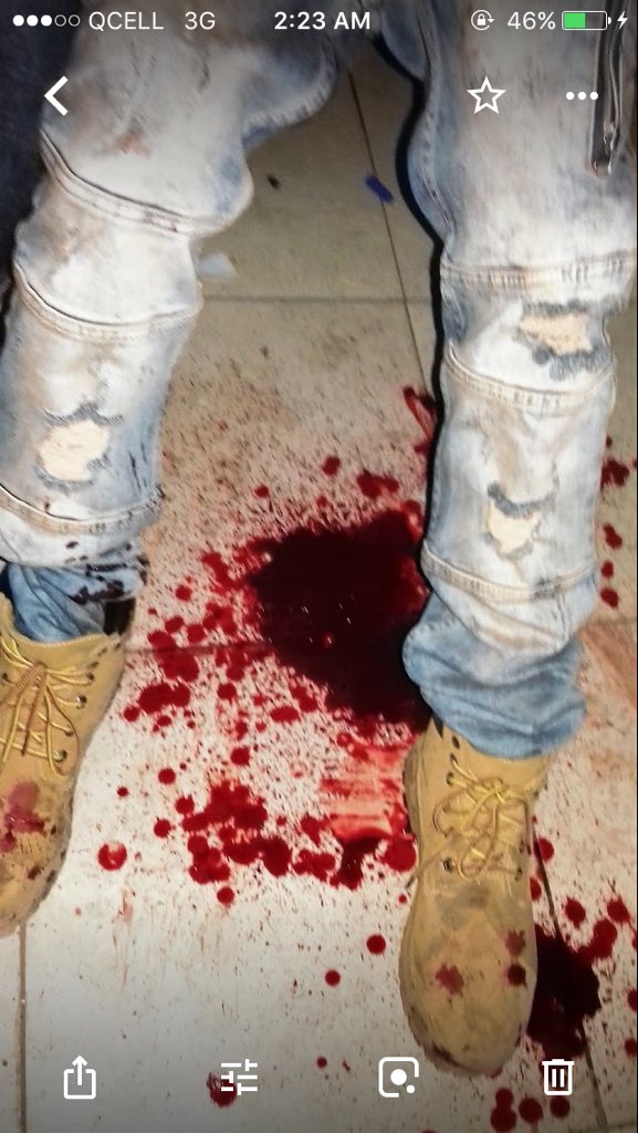 Hello greetings how are you all doing this my uncle and he really need help he was Attack by arm robbery was injured so need an operation please help him🙏🏿🙏🏿🙏🏿🙏🏿