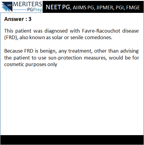 pg_prep's tweet photo. What is your diagnosis?
1.Acne vulgaris
2.Colloid milium
3.Favre and Racouchot disease
4.Sebaceous hyperplasia
5.Syringomas

#NEET_PG #AIIMS #JIPMER #PGI #DNB #Medicine #PG_Medical_Entrance #NEETPG #MedicalEntrance #Doctor #Medical #PGPrep #ImageMCQs #NEET_Mock_Test #Anaesthesia https://t.co/CkqQiwIXSs