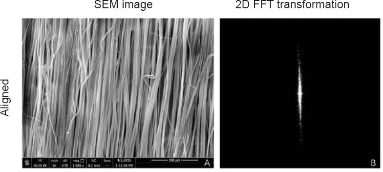 Aligned fibers enhance nerve guide conduits when bridging peripheral nerve defects focused on early repair stage
#peripheralnerveinjury #nerveguideconduit #alignedfiber #electrospinning #nanofiber

nrronline.org/text.asp?2019/…