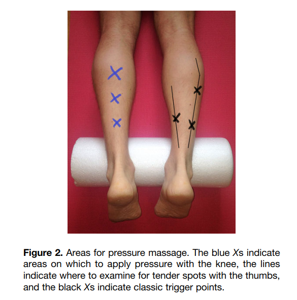 PhysioMeScience's tweet photo. Using Pressure Massage for Achilles Tendinopathy: A Single-Blind, Randomized Controlled Trial Comparing a Novel Treatment Versus an Eccentric Exercise Protocol.
🤔
https://t.co/07liCH0vP8 https://t.co/G9IFnvbbcS