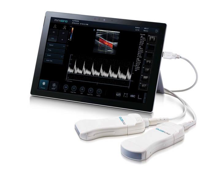 AlpinionFrance's tweet image. La Tablette @minisono d'@Alpinion  enfin disponible en France. #echographe #échographie #centrecho #alpinion #alpinionfrance