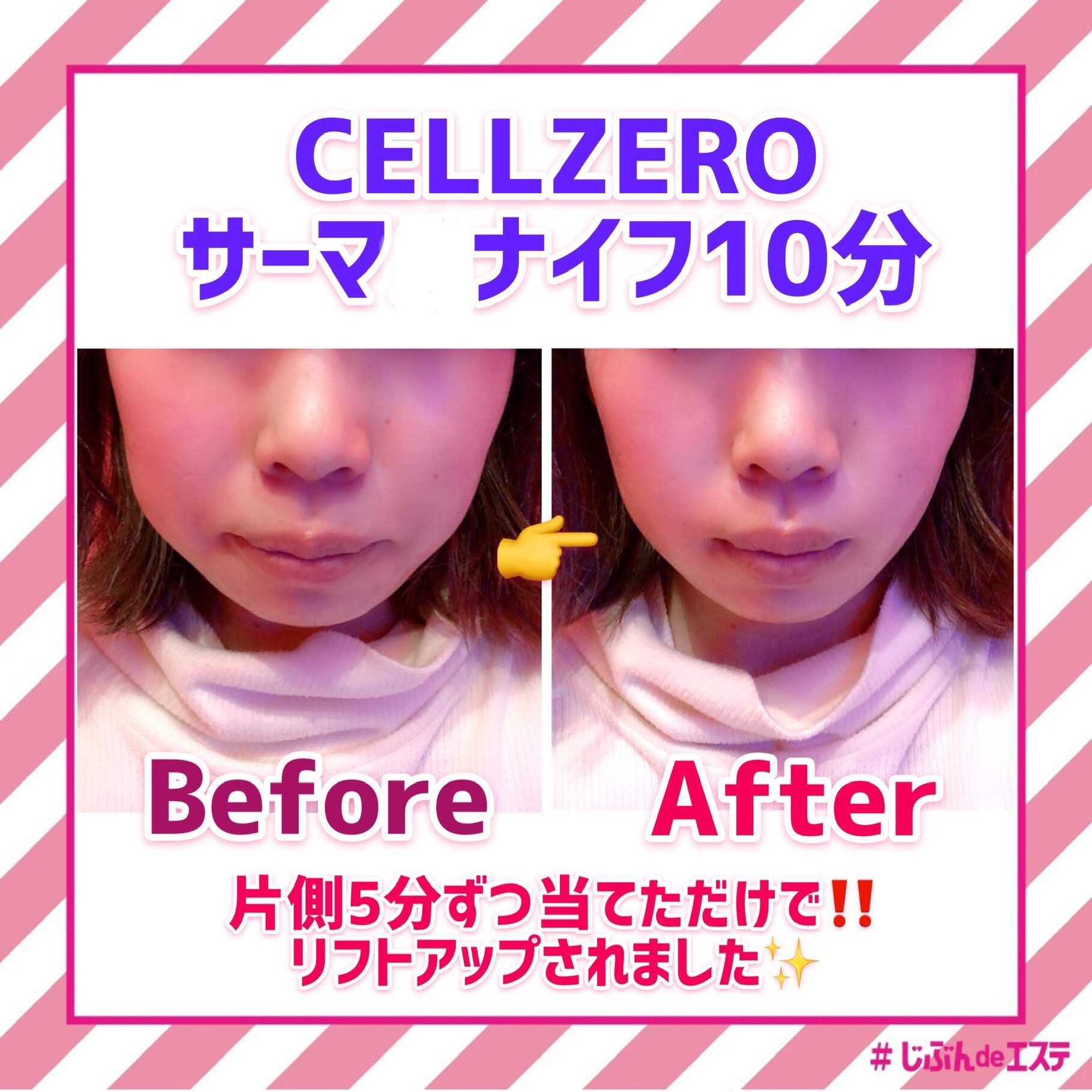 じぶんdeエステ セルゼロ じぶんdeエステSTAFF on X: 