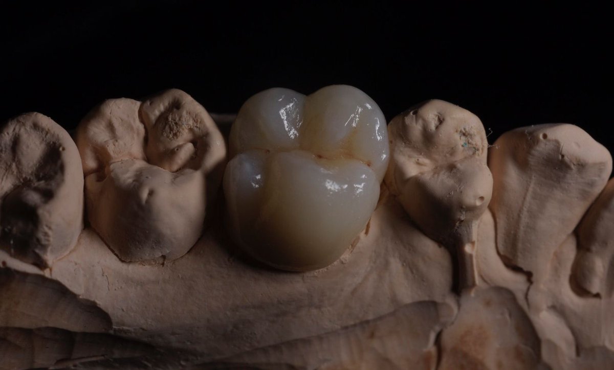 Queenswaylab's tweet photo. Looks like snow on a mountain range, anyone want to go skiing? ⛷⛷

Some final detailing going into a LiSi crown adding more translucency and life. We, as a lab, always try to make crowns that fit into the environment around them. https://t.co/Ig1V6aoMFw