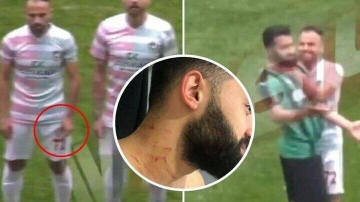 TurkcuPaylasim's tweet photo. Sakaryasporlu futbolcuları jiletle yaralayıp “ömür boyu men” alan TERÖRİSTİN cezası, Türk Futboluna katacağı çok şey olduğu düşünülerek 20 maça indirildi. Teşekkürler @Tff_org https://t.co/lCf6QYwe74