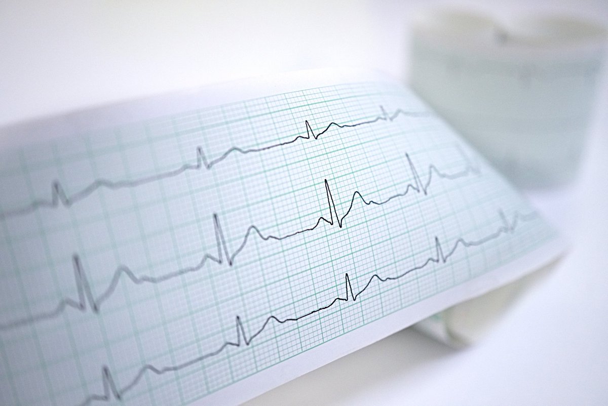 gesanor's tweet photo. Seguro que ya habrás oído hablar del electrocardiograma, pero ¿qué es esta prueba médica? ¿Para qué sirve? https://t.co/ZNCSIDB57K https://t.co/meTzQPCR39