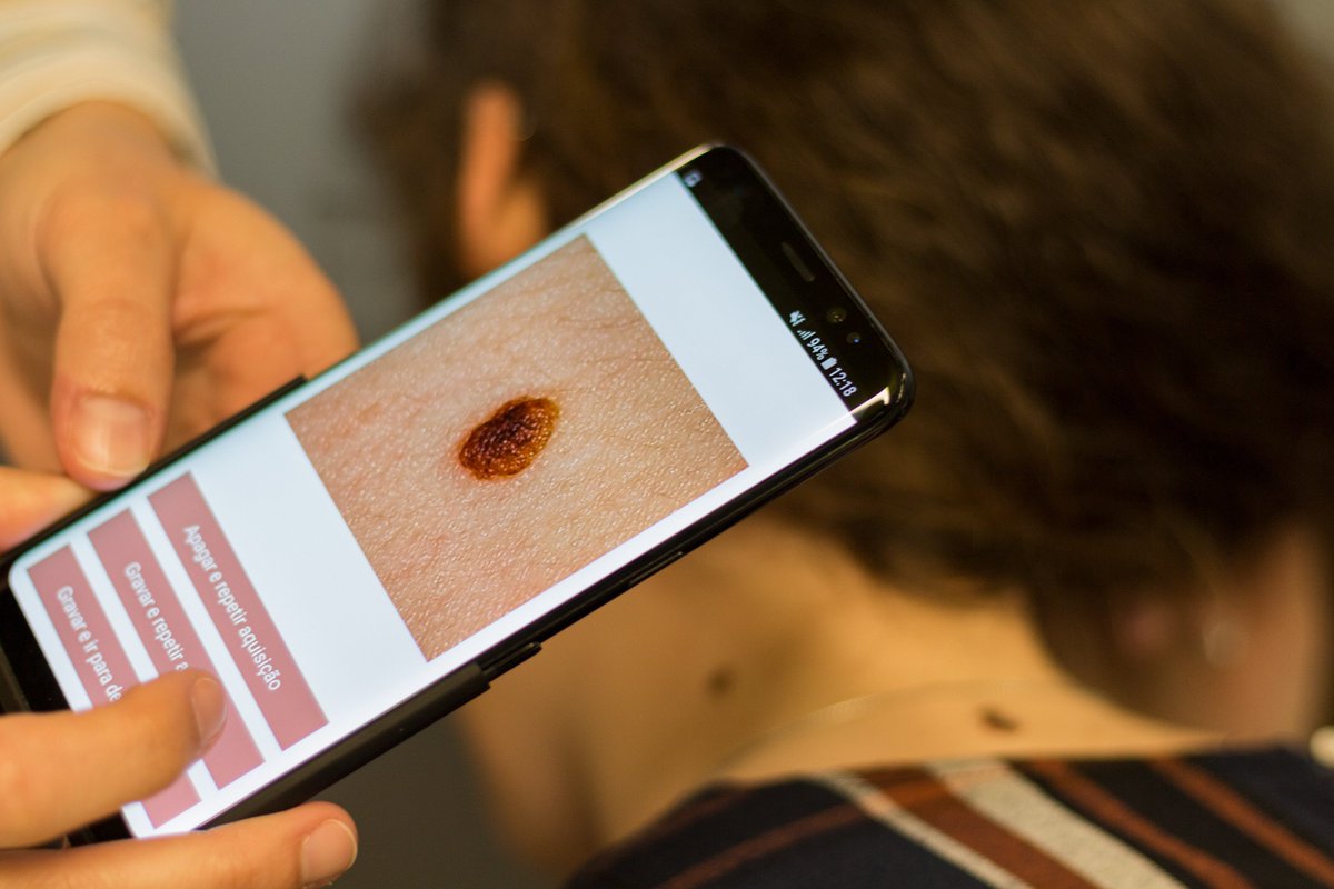 FhP_AICOS's tweet photo. “Portugal em Direto”, a radio show from Antena 1, visited us today to learn more about DERMAI, a project that uses artificial intelligence (AI) to enhance the screening of skin cancer.
#AICOS #ArtificialIntelligence #MachineLearning #DERMAI #SPMS #Antena1 #PortugalemDireto https://t.co/DBO5BwTqIo