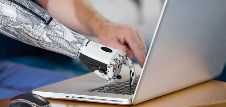 PredictSense's tweet photo. How AI and machine learning are changing prosthetics
#MachineLearning #ArtificialIntelligence #PredictSense #SmartProsthetics #DeepLearning #PredictiveAnalytics #Amputations #RoboticSystem
https://t.co/FoWRrOSkye https://t.co/8qf5fziM1X