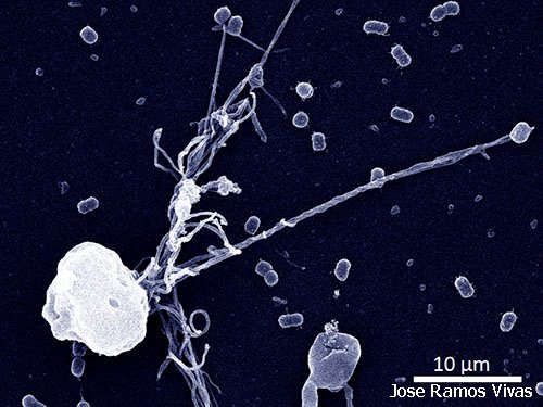 Nuestra foto más espectacular del año. Y está más cerca que un agujero negro...
Es un neutrófilo humano capturando #bacterias mediante "tentáculos celulares". Una herramienta desconocida en este tipo de células. <a href="/IDIVALdecilla/">IDIVAL</a>