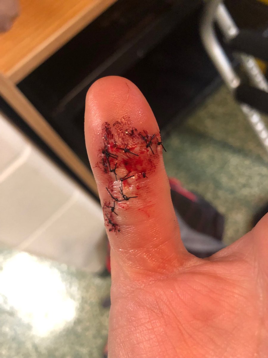 Coach_BigJim's tweet image. Well, this weekend is out softball for Erin Keeney! Darn tomato sauce can! No more kitchen for you. We will still be out there to root for NW Missouri State this weekend! ⁦@NWBearcatSB⁩ ⁦@bearcatsports⁩ ⁦@KCElite⁩