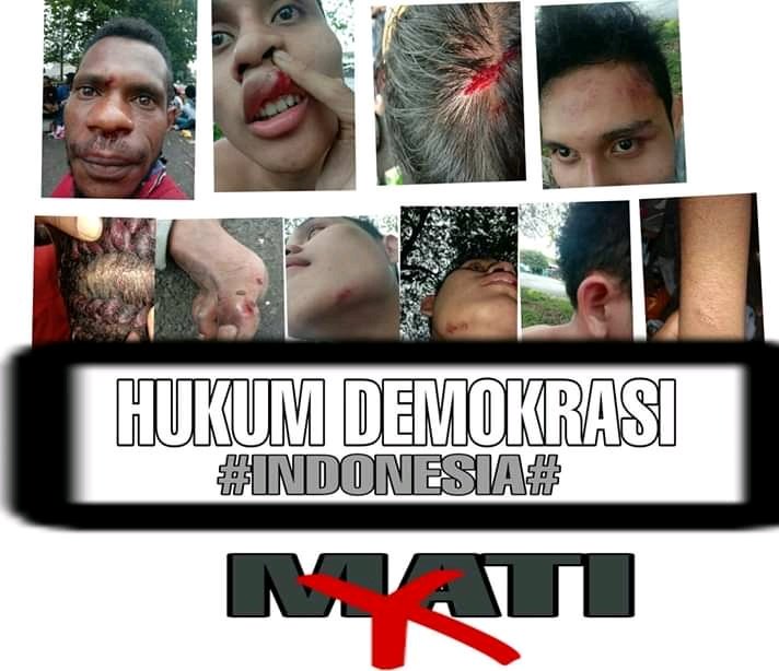MB20066058's tweet photo. Republic of Indonesia state constitution Article 28 E paragraph 3 which reads every person has the right to express public opinion, does this violate the Law "Basic ? https://t.co/b9OJxr8HoP
