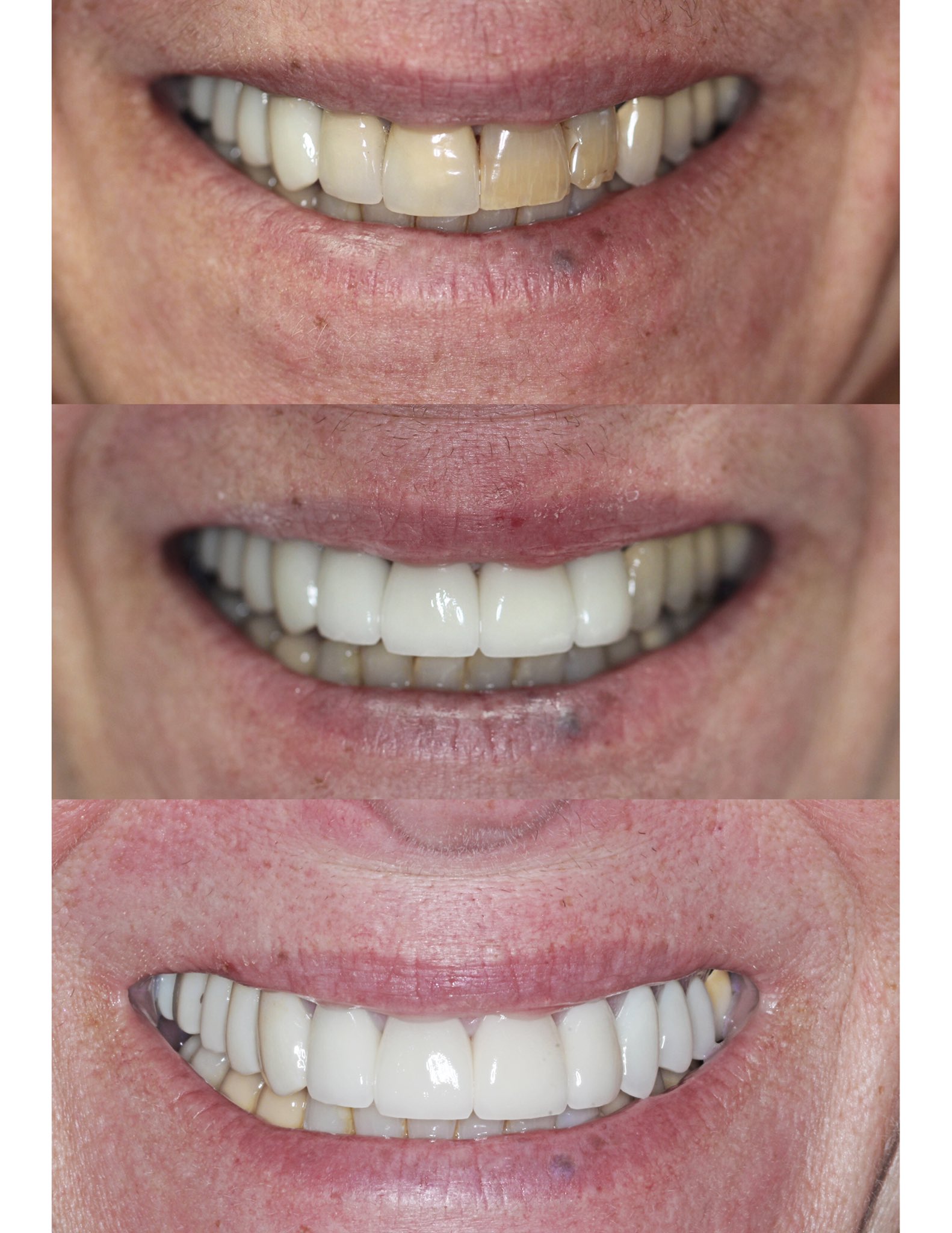 IDOC Dental Lab (IDOCdentalLab) / Twitter