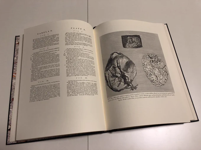 昨日はフォント(4/10)の日との事で、18世紀イギリスの活字デザイナー、ジョン・バスカヴィル(John Baskerville 1706-1775)が関わった解剖学書。ウイリアム・ハンター『ヒト妊娠子宮の解剖学』(1775)。ハンターは英国王室の産科医。書籍には質の高いイラストレーター、タイポグラファーが関わった。 