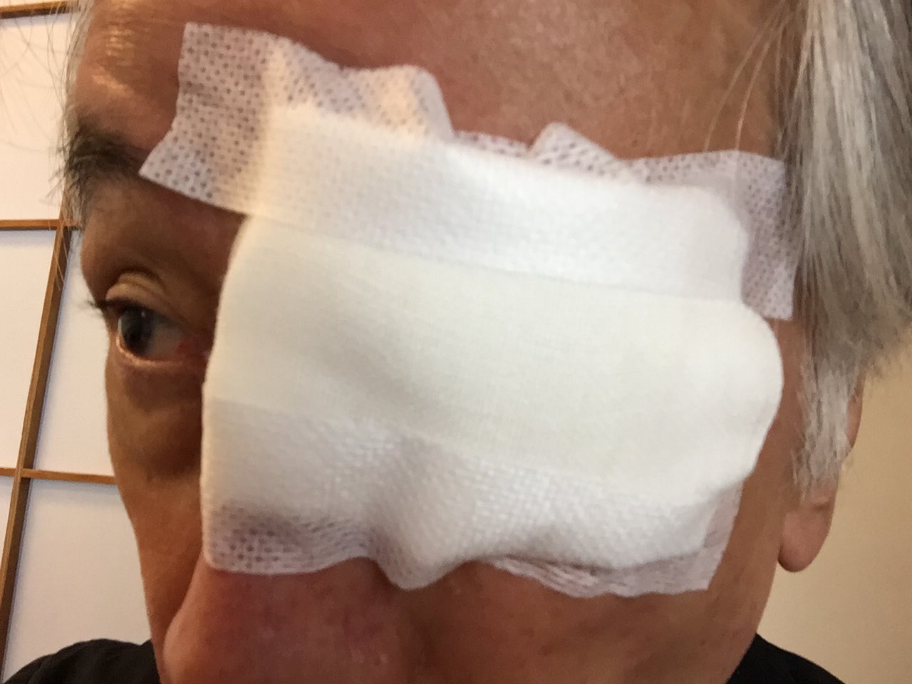 眼球麻酔インサート