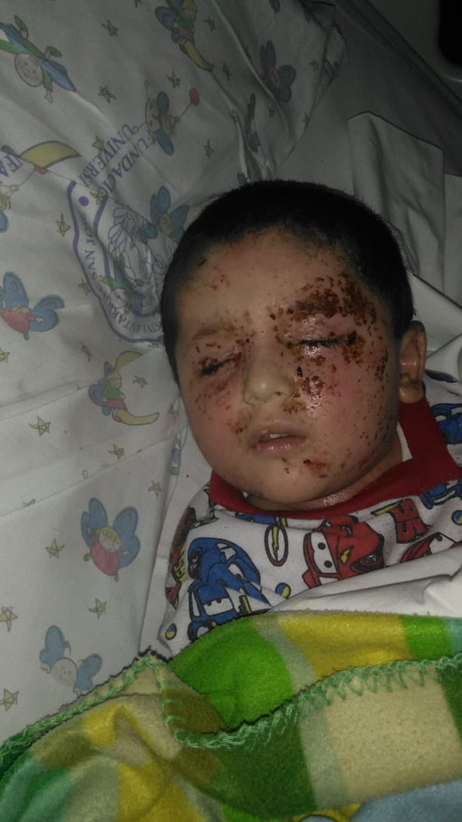 alexandramonto's tweet photo. Este niño se llama Rafael, su papa Felix Eduardo Pinilla esta encadenado esperando que la EPS Servisalud le entregue el medicamento para la piel de su hijito. La EPS dice que no, porque es de uso cosmético, que tal? https://t.co/dkAn8v2oD2