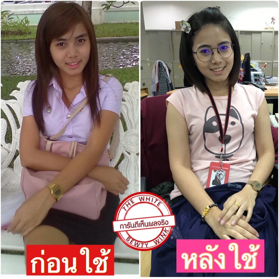 NNaramol's tweet photo. อดีตเคยดำ ปัจจุบ���นขาวขึ้นแล้วนะ ผิวขาวขึ้นได้ก็เพราะ #เดอะไวท์โลชั่นตัวนี้แหล่ะ ❌ไม่เน้นสินค้าตามกระแส ✅เน้นใช้แล้วได้ผลจริง 🤭ไม่ต้องพูดเยอะให้รีวิวตัวนุชเองมันเล่าเรื่อง #howtopefect #ครีมขาว #howtoperface #รีวิวจากผู้ใช้จริง #เดอะไวท์ดำแค่ไหนก็ขาวได้ #ของดีบอกต่อ #ส่งฟรีEMS https://t.co/qtWSqu5XWo
