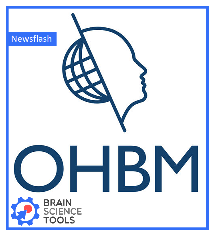 brainscitools's tweet photo. We are very excited to announce that we'll be at @OHBM in #Rome to showcase our Neural Navigator for #TMS systems. We are looking forward to a great meeting with #scientists of various backgrounds from all over the world! #OHBM2019 @OHBM_Trainees https://t.co/QSaE8pREkA