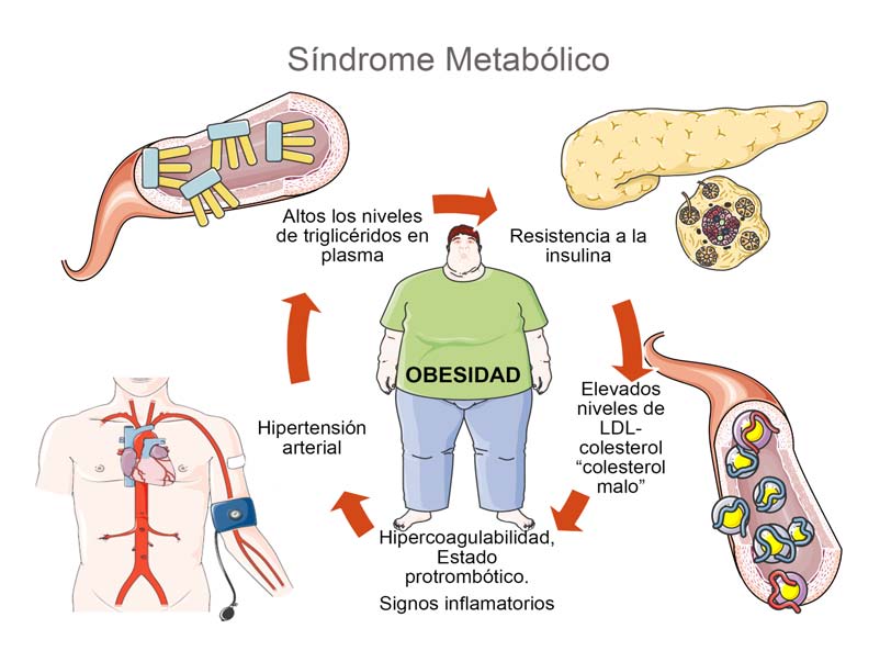 Sindrome metabolico tratamiento natural